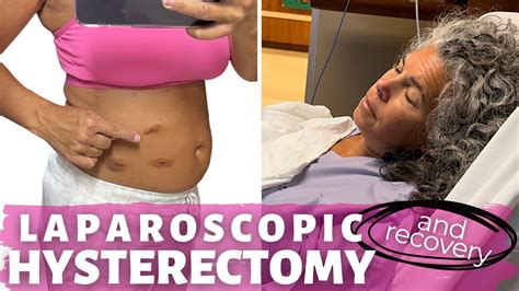 hysterectomy recovery setbacks|Laparoscopic Hysterectomy: What to Ex.